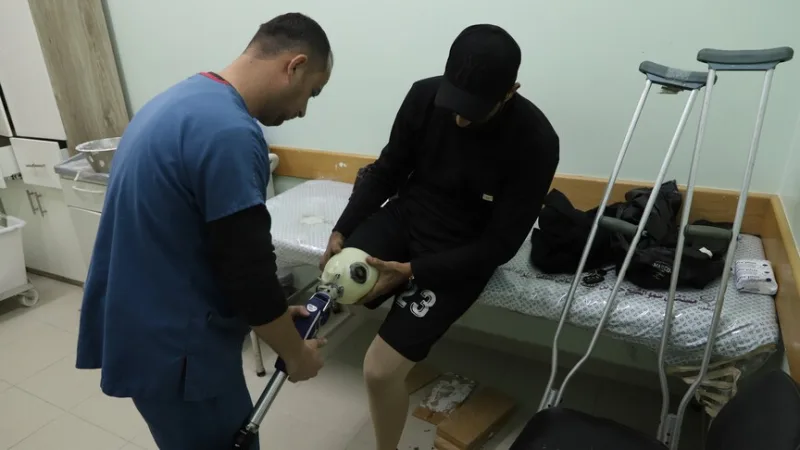 在以色列封锁下的加沙地带，巴勒斯坦人为了获得假肢，不得不等待数月之久