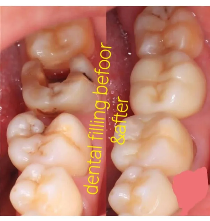 Alanya HEALTHY TEETH Dental Aesthetic — Medizin in Alanya: Online-Bestellung, Preise und Bewertungen
